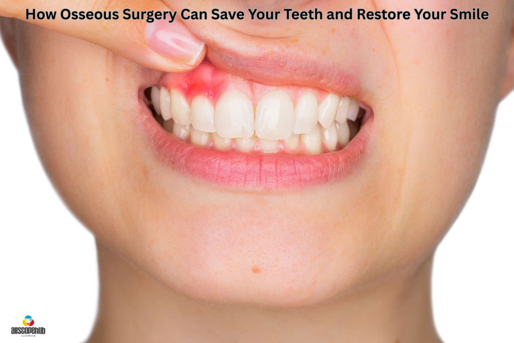 Osseous Surgery